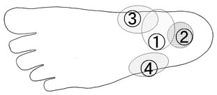 Q A 足の裏の痛み ウォーキングのための膝痛 腰痛などのセルフケア Ppkに向けて歩こう